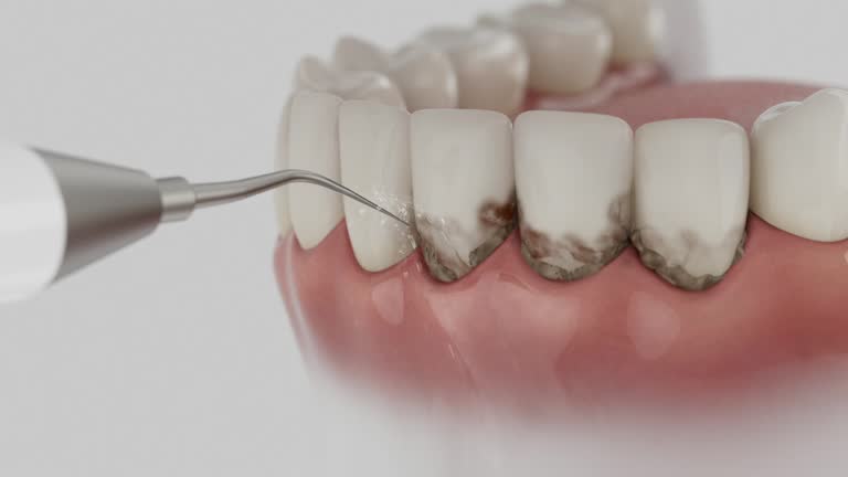 Reliable Dental Implants contractor in Kilmarnock, VA by Smile Center Dentistry